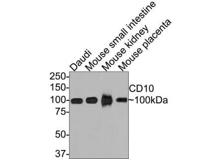 Western Blot: Neprilysin/CD10 Antibody (SN75-07) [NBP2-67717]