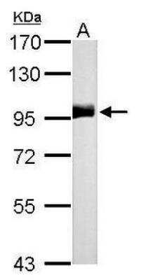 Western Blot: Neprilysin/CD10 Antibody [NBP2-15771]