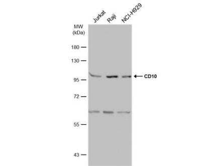 Western Blot: Neprilysin/CD10 Antibody [NBP2-15771]