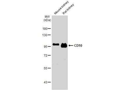 Western Blot: Neprilysin/CD10 Antibody [NBP2-15771]