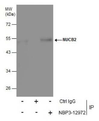 Immunoprecipitation: Nesfatin-1/Nucleobindin-2 Antibody [NBP3-12972]