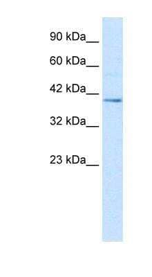 Western Blot: Nesfatin-1/Nucleobindin-2 Antibody [NBP1-57951]