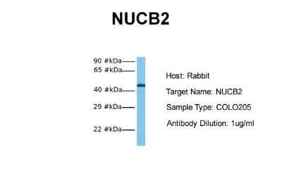 Western Blot: Nesfatin-1/Nucleobindin-2 Antibody [NBP1-57952]