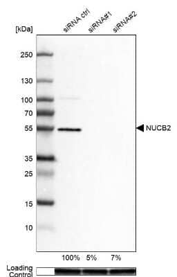 Western Blot: Nesfatin-1/Nucleobindin-2 Antibody [NBP1-87383]