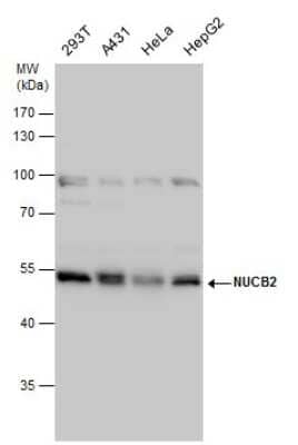 Western Blot: Nesfatin-1/Nucleobindin-2 Antibody [NBP3-12972]