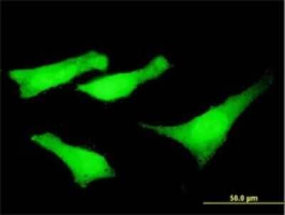 Immunocytochemistry/ Immunofluorescence: Nesprin 2 Antibody (5E5) [H00023224-M01]