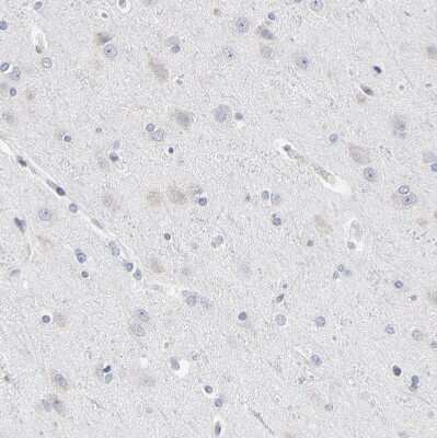 Immunohistochemistry-Paraffin: Nesprin 2 Antibody [NBP1-84190]