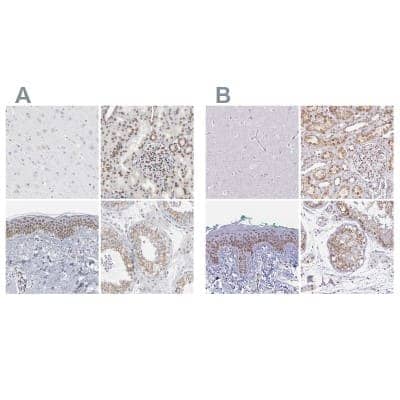 Immunohistochemistry-Paraffin: Nesprin 2 Antibody [NBP1-84190]