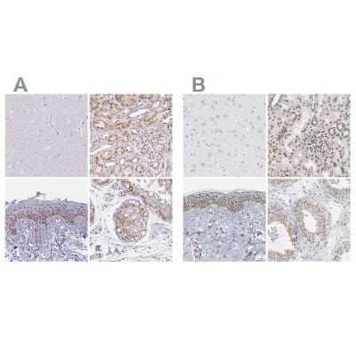 Immunohistochemistry-Paraffin: Nesprin 2 Antibody [NBP2-38620]