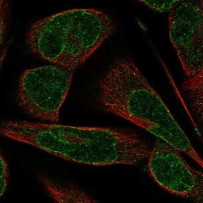 Immunocytochemistry/ Immunofluorescence: Nesprin-3 Antibody [NBP2-57690]