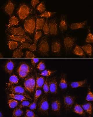 Immunocytochemistry/ Immunofluorescence: Nesprin-3 Antibody - Azide and BSA Free [NBP2-93890]
