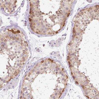 Immunohistochemistry-Paraffin: Nesprin-3 Antibody [NBP2-49175]