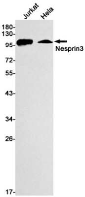 Western Blot: Nesprin-3 Antibody (S05-1B8) [NBP3-15067]