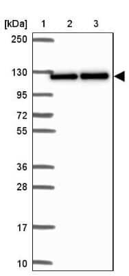 Western Blot: Nesprin-3 Antibody [NBP2-49175]