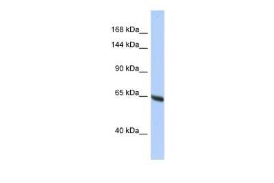 Western Blot: Nesprin-3 Antibody [NBP2-85375]