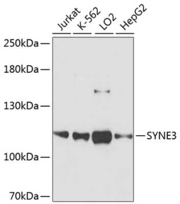 Western Blot: Nesprin-3 AntibodyAzide and BSA Free [NBP2-93890]