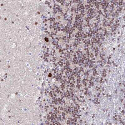 Immunohistochemistry-Paraffin: Nesprin-4 Antibody [NBP2-31811]