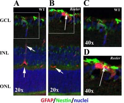 Immunohistochemistry: Nestin Antibody (10C2) - BSA Free [NB300-266]