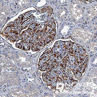 Immunohistochemistry-Paraffin: Nestin Antibody (10C2) - BSA Free [NB300-266]