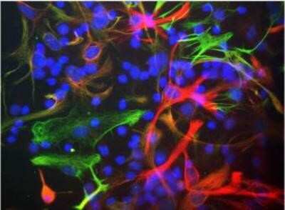 Immunocytochemistry/ Immunofluorescence: Nestin Antibody (4D11) [NBP1-92717]