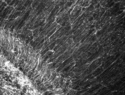 Immunohistochemistry: Nestin Antibody (4D11) [NBP1-92717]