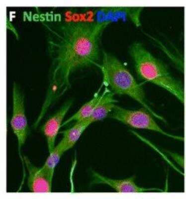 Immunocytochemistry/ Immunofluorescence: Nestin Antibody [NB100-1604]