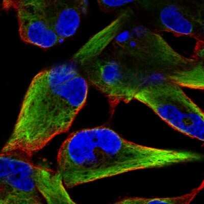 Immunocytochemistry/ Immunofluorescence: Nestin Antibody [NBP2-58884]