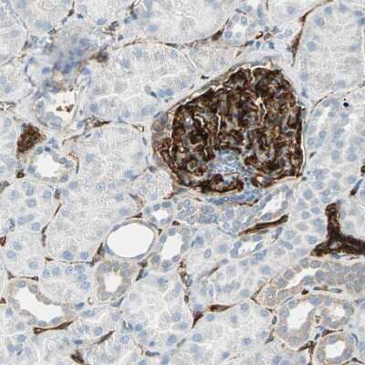 Immunohistochemistry-Paraffin: Nestin Antibody [NBP2-48504]