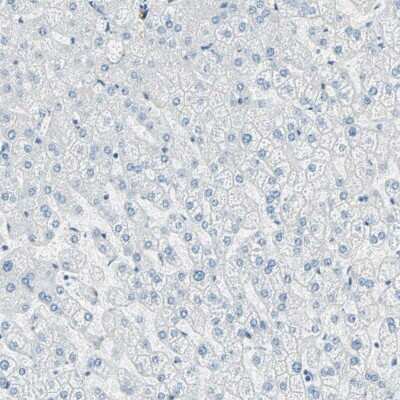Immunohistochemistry-Paraffin: Nestin Antibody [NBP2-48504]