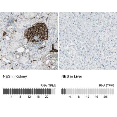 Immunohistochemistry-Paraffin: Nestin Antibody [NBP2-48504]