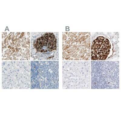 Immunohistochemistry-Paraffin: Nestin Antibody [NBP2-48504]