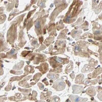 Immunohistochemistry-Paraffin: Nestin Antibody [NBP2-48504]