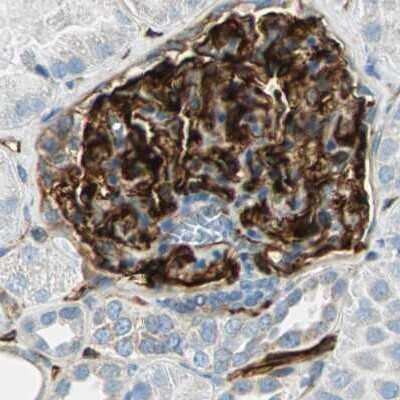 Immunohistochemistry-Paraffin: Nestin Antibody [NBP2-48504]