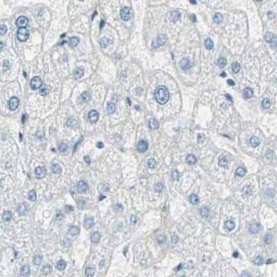 Immunohistochemistry-Paraffin: Nestin Antibody [NBP2-48504]