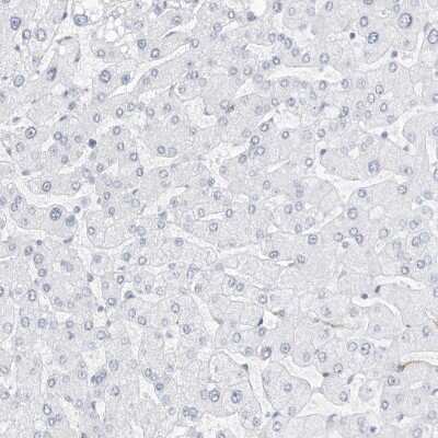 Immunohistochemistry-Paraffin: Nestin Antibody [NBP2-48575]