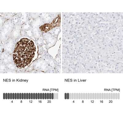 Immunohistochemistry-Paraffin: Nestin Antibody [NBP2-48575]