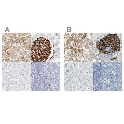 Immunohistochemistry-Paraffin: Nestin Antibody [NBP2-48575]