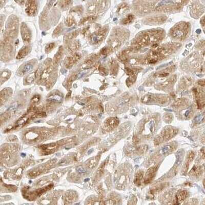 Immunohistochemistry-Paraffin: Nestin Antibody [NBP2-48575]