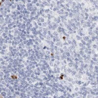 Immunohistochemistry-Paraffin: Nestin Antibody [NBP2-48575]