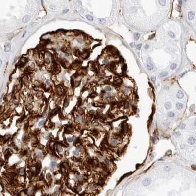 Immunohistochemistry-Paraffin: Nestin Antibody [NBP2-48575]