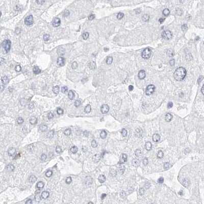 Immunohistochemistry-Paraffin: Nestin Antibody [NBP2-48575]