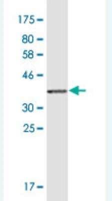 Western Blot: Netrin-1 Antibody (5H8) [H00009423-M01]