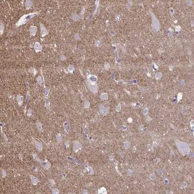 Immunohistochemistry-Paraffin: Netrin-1 Antibody [NBP2-31640]