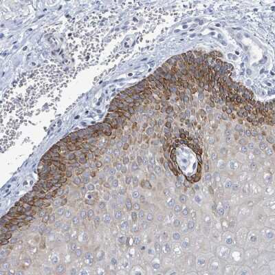 Immunohistochemistry-Paraffin: Netrin-2 Antibody [NBP2-30487]