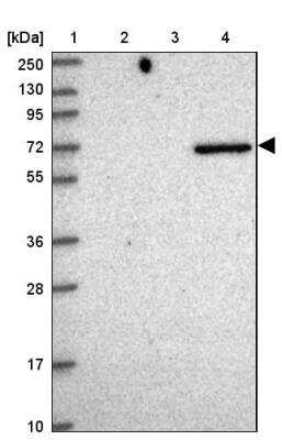 Western Blot: Netrin-2 Antibody [NBP2-30487]