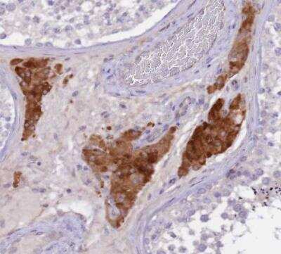 Immunohistochemistry-Paraffin: Netrin-4 Antibody [NBP2-13680]