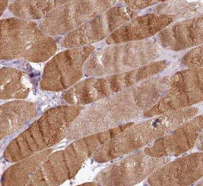 Immunohistochemistry-Paraffin: Netrin-4 Antibody [NBP2-13680]