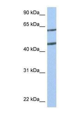 Western Blot: Netrin-4 Antibody [NBP1-91343]