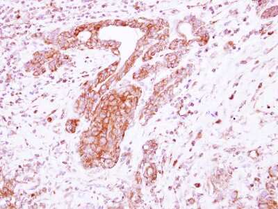 Immunohistochemistry-Paraffin: NGL-1/LRRC4C Antibody [NBP2-19516]