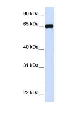 Western Blot: NGL-1/LRRC4C Antibody [NBP1-59669]